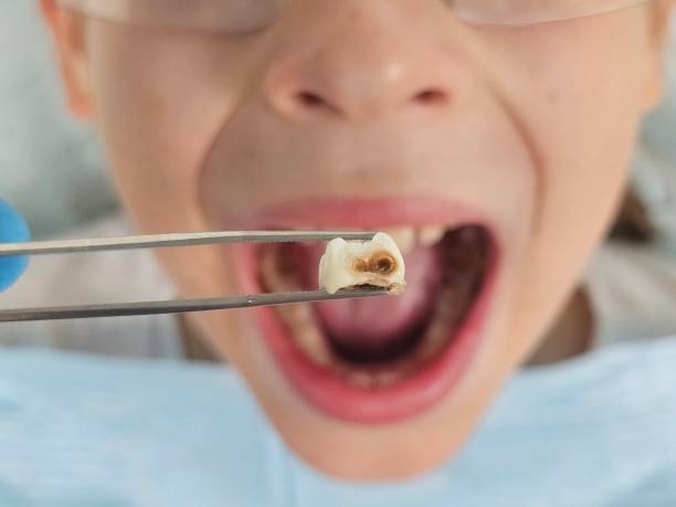 Best Pediatric Emergency Dentist in Rainbow Lakes Estates, FL